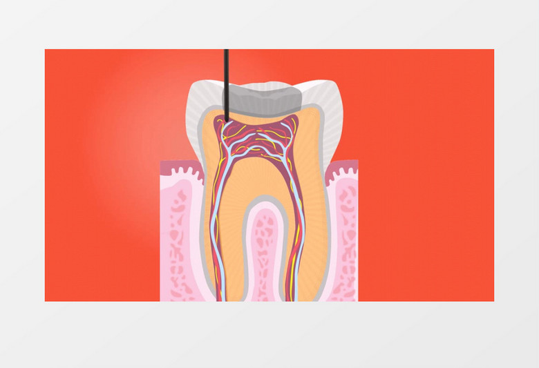 医院牙齿手术3d立体动画模型视频素材
